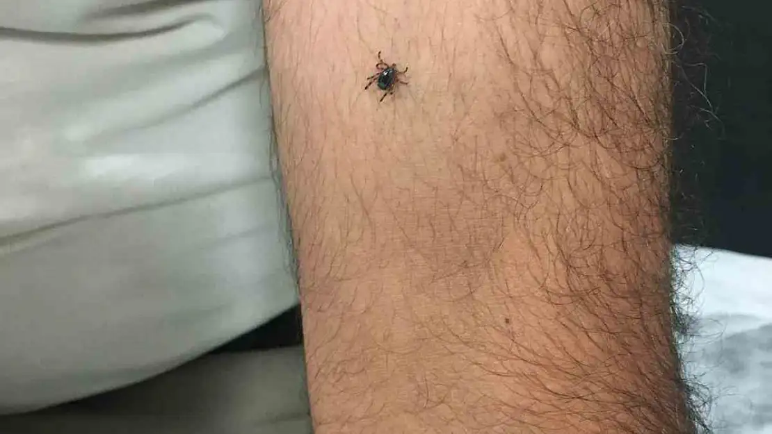 Kayseri'nin bir ilçesinde daha kene vakası