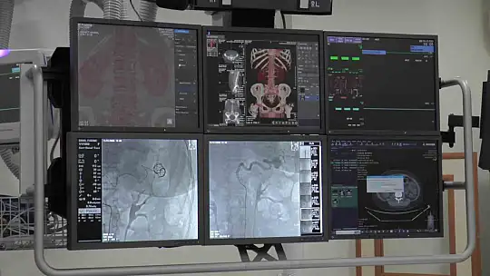 ERÜ'de yeni alınan 'anjiyografi' ve 'ultrasonografi' cihazı hizmete başladı
