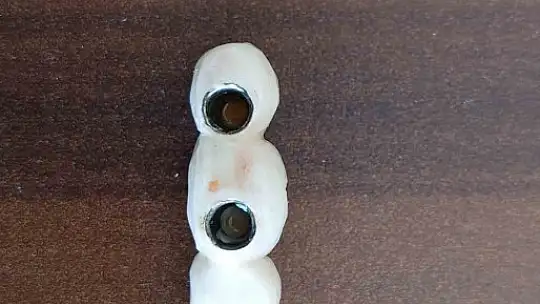 İmplant elinde hasta şikayette