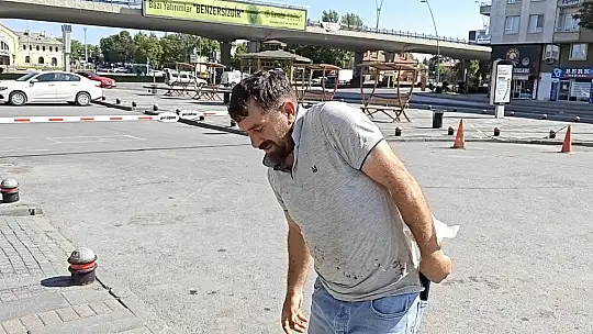 Kayseri'de acemi kasaplar soluğu acil serviste aldı
