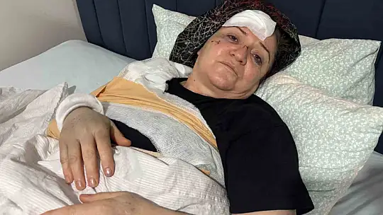 Kayseri'de aracın, refüjdeki yayaların arasına daldığı kazada kamerada