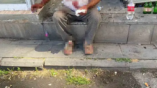 Kayseri'de bir günde 3 farklı olayda bıçaklanan 3 kişi cinayete kurban gitti