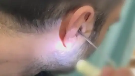 Kayseri'de kulağının içine uyuşturucu saklayan şüpheli yakalandı