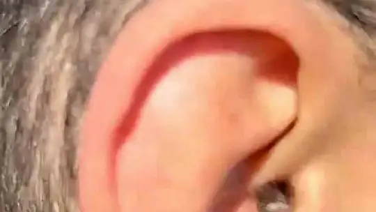 Kayseri'de kulağının içine uyuşturucu saklayan şüpheli yakalandı