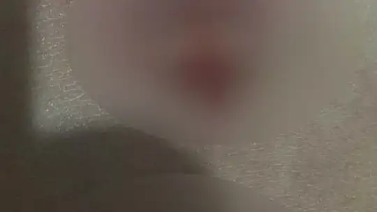 Yağ aldırma ameliyatı geçirdi hayatı karardı