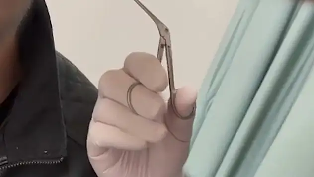 Kayseri'de kulağının içine uyuşturucu saklayan şüpheli yakalandı