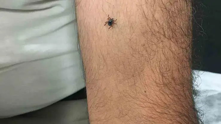 Kayseri'nin bir ilçesinde daha kene vakası