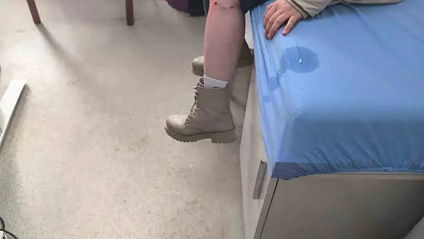 Kayseri'de sokak köpeğinin saldırısına uğrayan çocuk yaralandı