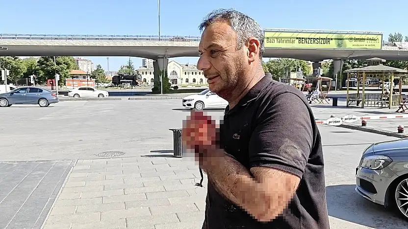 Kayseri'de acemi kasaplar soluğu acil serviste aldı