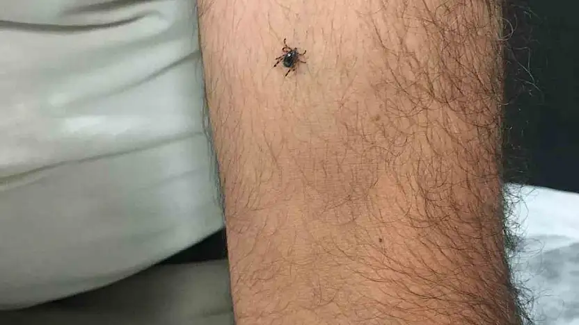 Kayseri'nin bir ilçesinde daha kene vakası